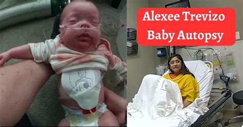 All we know. Alexee Trevizo pleaded not guilty to first-degree murder after allegedly suffocating her newborn baby in a hospital trash can. The 19-year-old told police that the child was dead upon birth. An autopsy refuted Alexee’s claims, concluding that the baby had air in his lungs and had no defects consistent with a stillbirth.